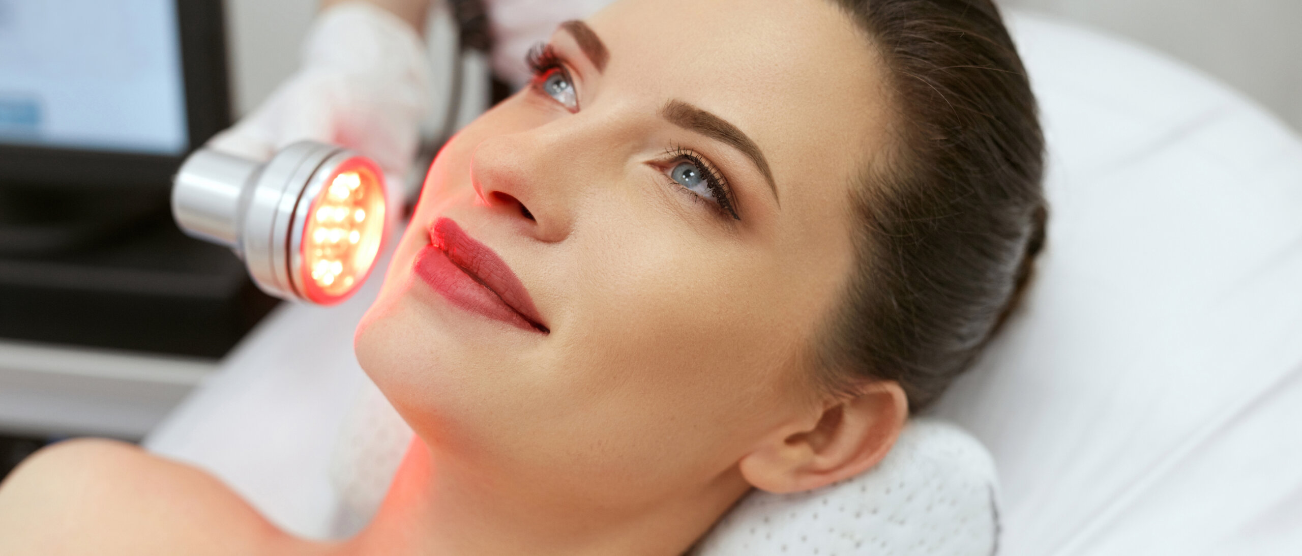 Laser Redness/Rosacea Treatment