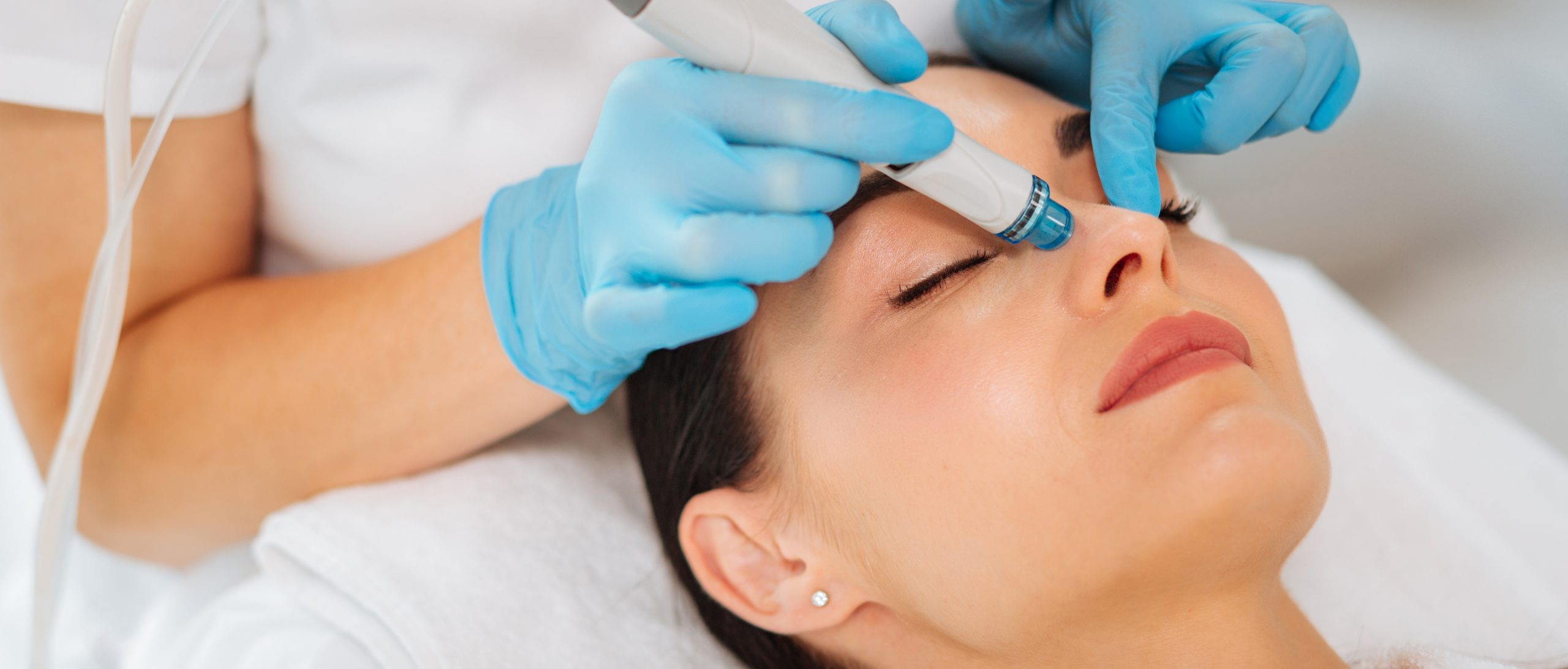 Clearlift Laser Treatment