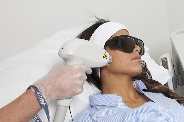 Laser Ipl Treatment